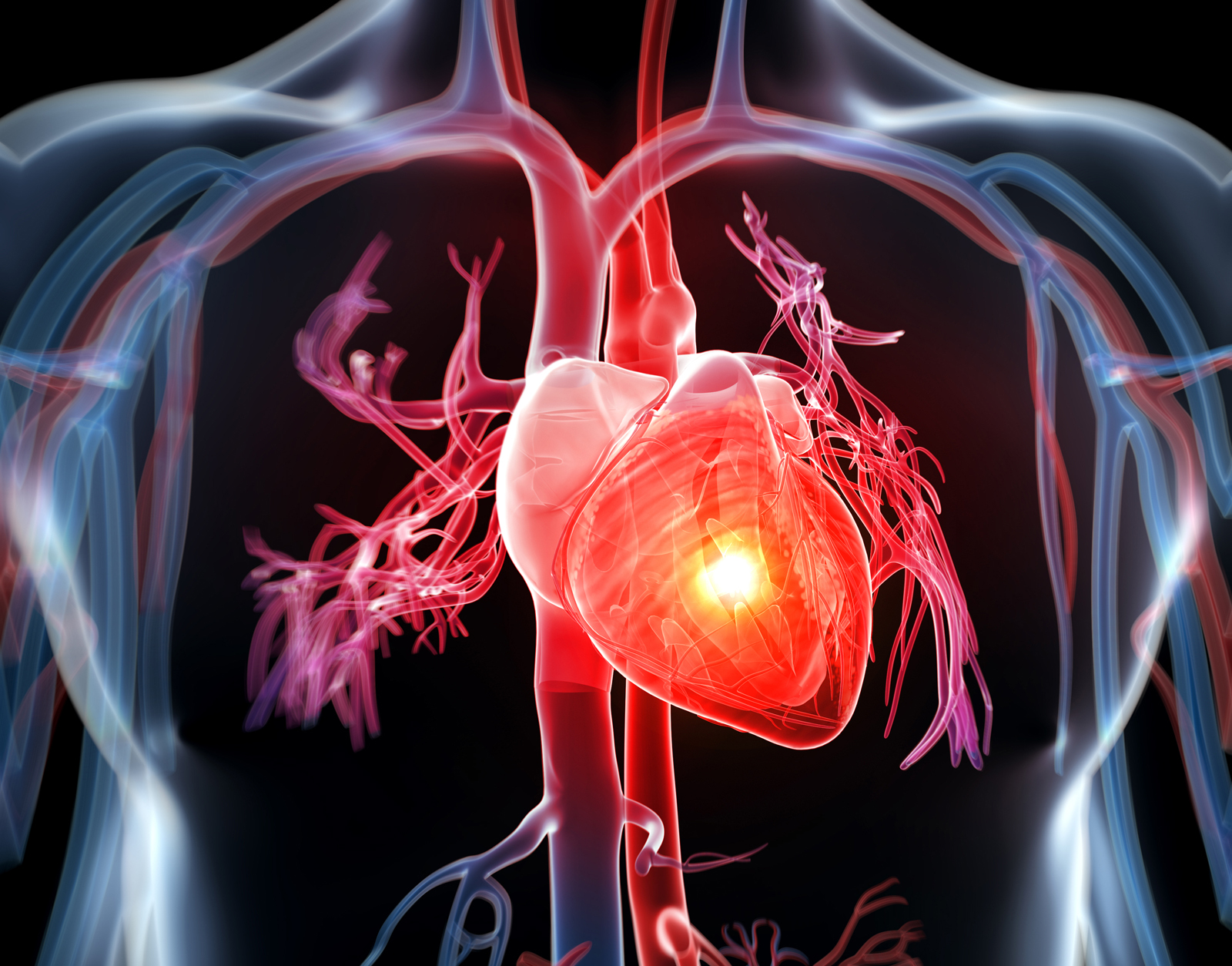 Heart disease image